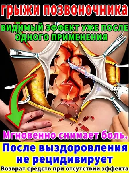 Мазь от грыжи позвоночника, 55 г