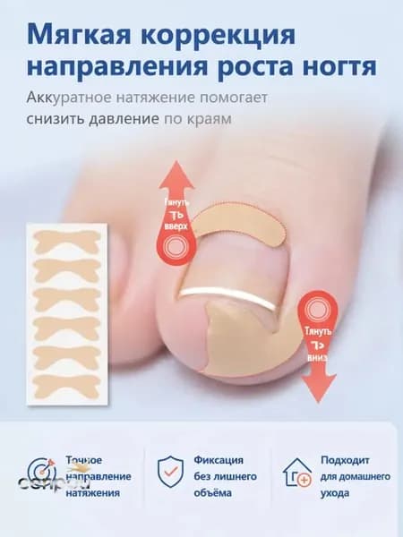 Наклейки от вросшего ногтя,20 шт