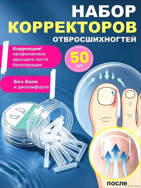 Корректор от вросшего ногтя, вставка для ногтей на ноге