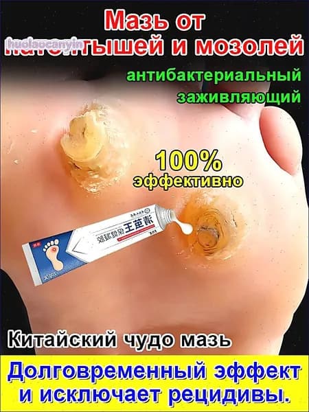 Качественный крем 20 г для удаления стержневых мозолей, сухих натоптышей, шипиц и бородавок