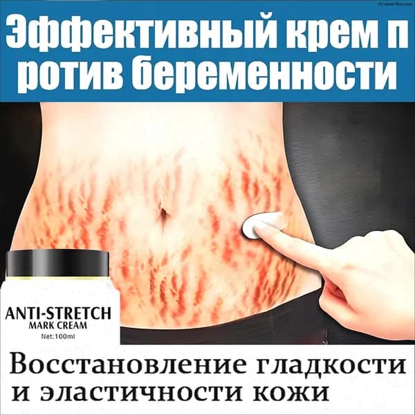 Крем от растяжек 100 мл Быстрое удаление шрамов и растяжек после родов Восстанавливает эластичность кожи Питает кожу