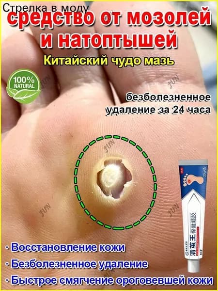 Пластырь от мозолей, бородавок и натоптышей лечебный, быстрое смягчение, безболезненное удаление,20 г.