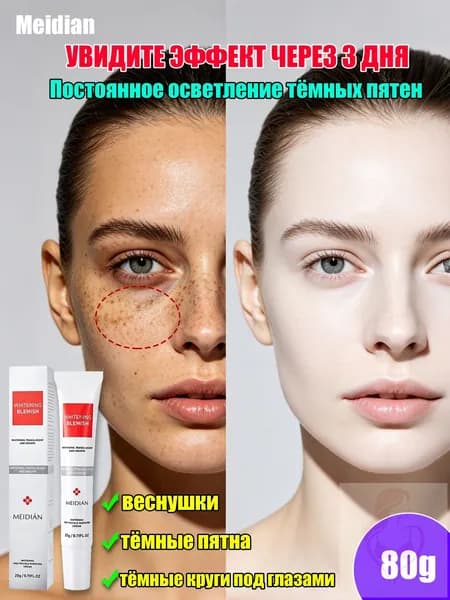 MEIDIAN Крем для отбеливания веснушек, осветление пигментных пятен, меланодермия, подбитый глаз 20g 4 шт