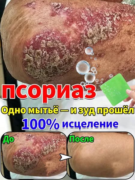 Твердое мыло