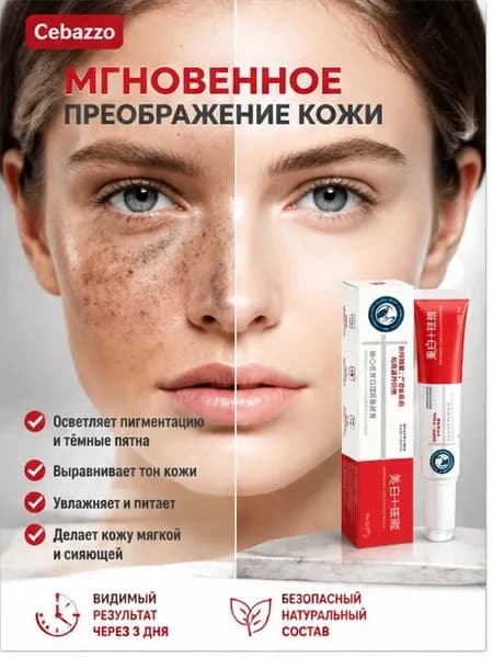 YUXING Крем для осветления веснушек, пигмента и темных кругов под глазами 20г 1 шт