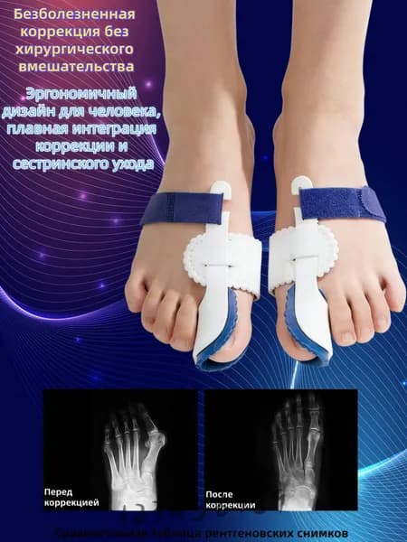 Ортопедический корректор для пальцев ног, регулируемый фиксатор с , разделитель для большого пальца, универс