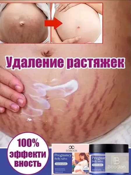Беременный крем для живота от растяжек, интенсивное увлажнение, устранение стрий на коже
