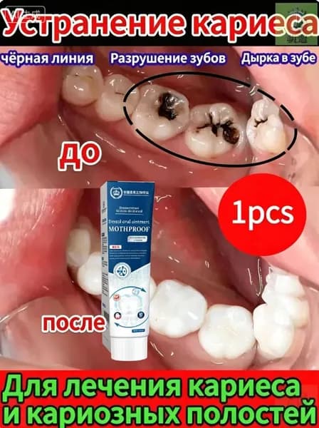 Зубная паста для дырки в зубе, глубокого кариеса и пульпита, Снимает боль, восстанавливает при поражении кариесом у взрослых, Свежее дыхание, 100 г, 1 шт.
