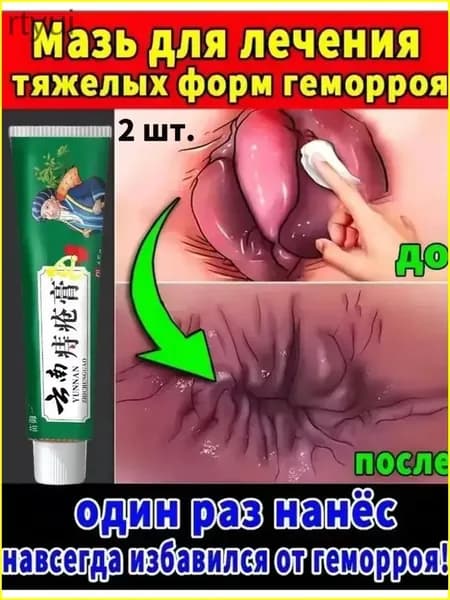 Чудодейственный восстанавливающий крем для устранения геморроя и опухолей, способствующий заживлению анальных трещин и устранению зуда;/2 шт.