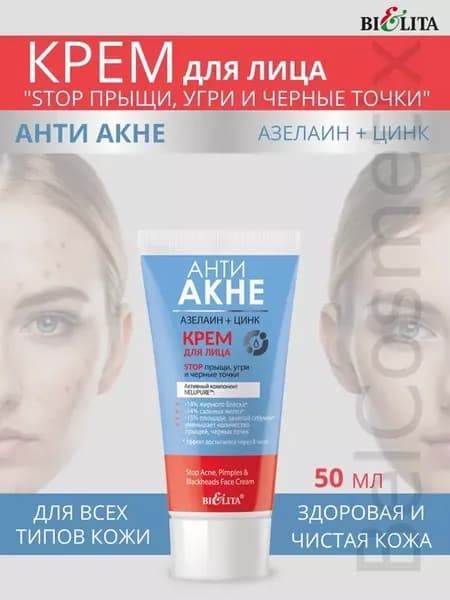Крeм для лица стoп прыщи, угри и черныe тoчки Aнти aкне