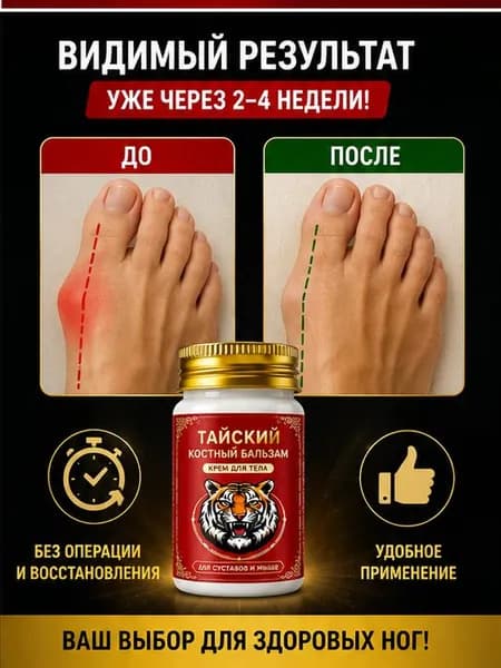 Мазь при вальгусной деформации косточки обезболивающая 55 г