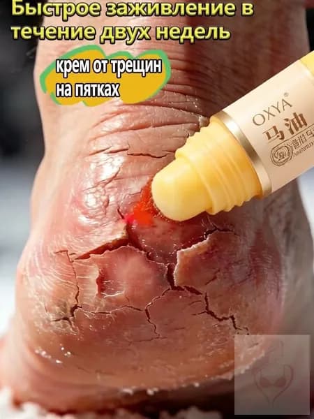 Крем воск для ног с мочевиной 5 , от трещин на пятках, увлажняющий