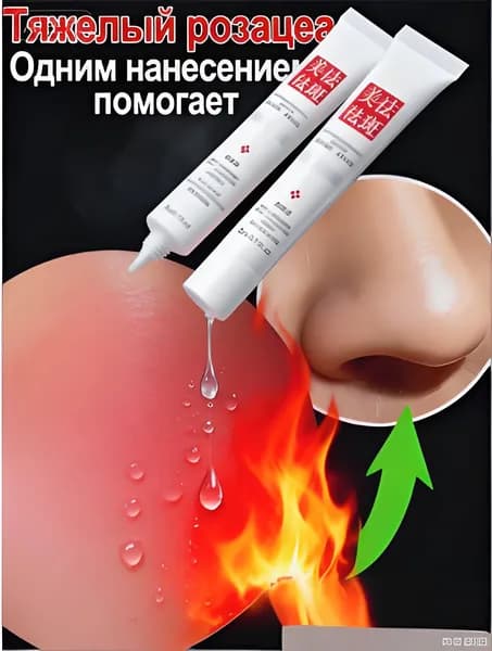 Крем для лечения розацеа и покраснений на лице, а также Куперофаг средство для лечения телеангиэктазии и покраснений, чудодейственный китайский крем. 20 г, 2 флакона