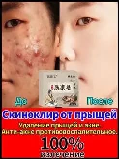Аптечное мыло из Гонконга от прыщей и акне
