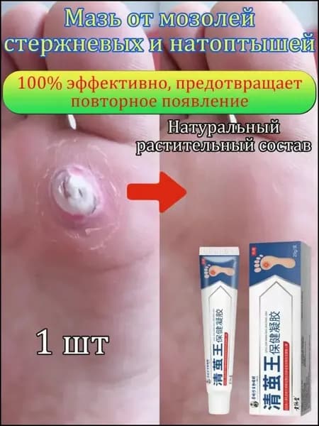 Mазь от мозолей стержневых и натоптышей ,Крем от сухих мозолей, шипицы, бородавок, натоптышей,20 г 1 шт.