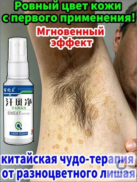 мазь от разноцветного лишая