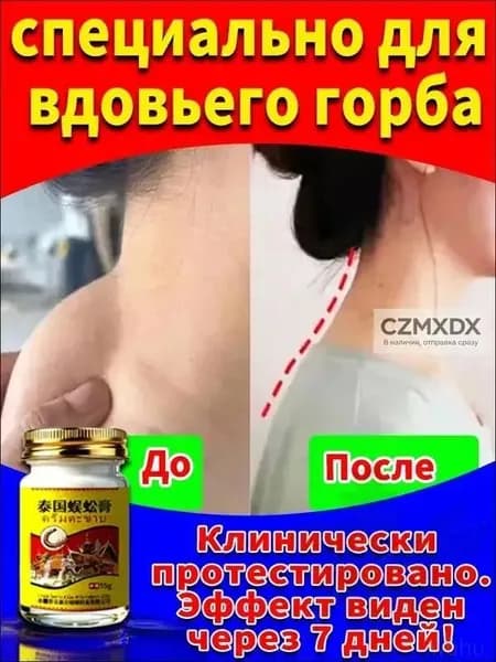крем от вдовьего горбика 55g