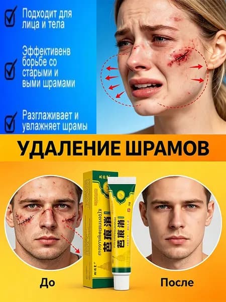 Крем от шрамов и рубцов, гель от прыщей на лице, мазь против ожогов и пигментных пятен и теле, средство от постакне18 г