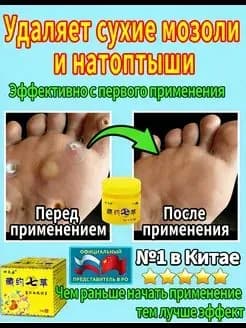мазь от мозолей и натоптышей на ногах20 r