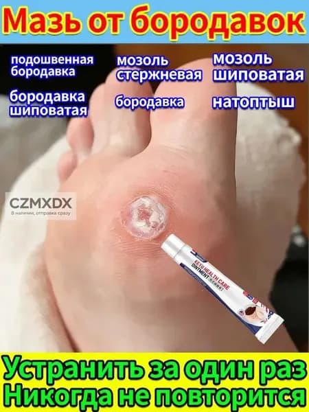 Лечение шипицы на стопе и подошвенной бородавки - крем от сухих мозолей