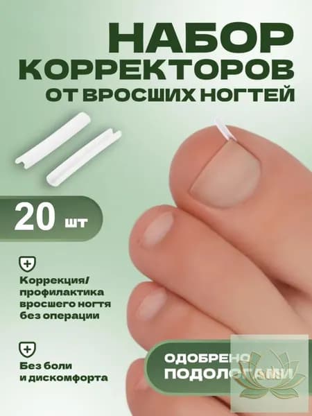Корректор От Вросших Ногтей На Ногах