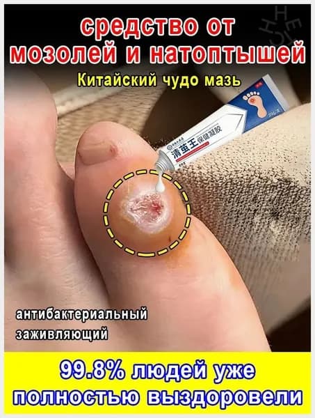 Пластырь от мозолей, стержневых натоптышей и бородавок 20 г Китайский чудо мазь