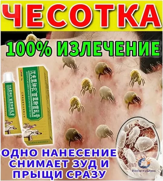 Мазь от чесотки для людей эффективное средство от чесотки и зуда, быстродействующая zheze