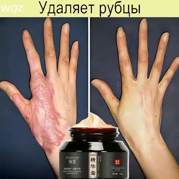 Крем для лица и тела от шрамов, растяжек пигментации, 50 г, без отдушек