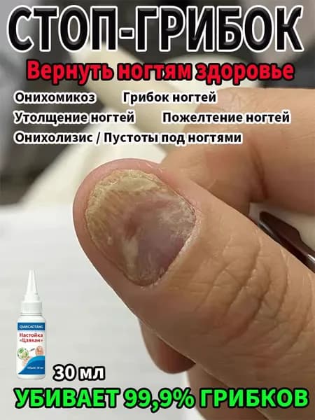 Глубокое проникновение против грибка ногтей. Восстанавливает цвет и структуру, убирает пустоты и утолщение. Для ежедневного ухода.