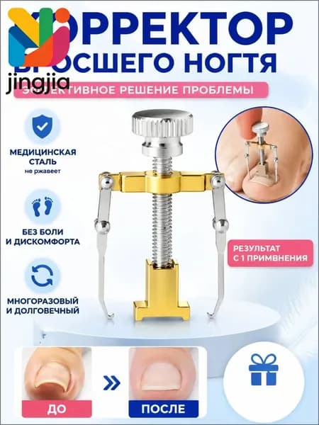 Коррекция вросших ногтей