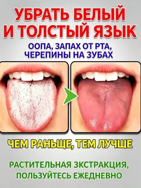 Спрей от трещин и белого налета на языке, лечит глоссит, освежает дыхание 20 мл
