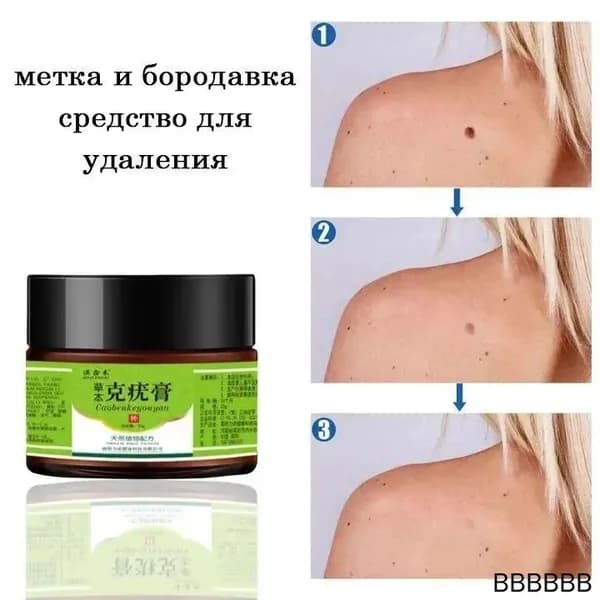 Эффективный крем для удаления бородавок, 20 грамм, натуральная растительная формула, щадящий метод удаления, не повреждает и не раздражает кожу