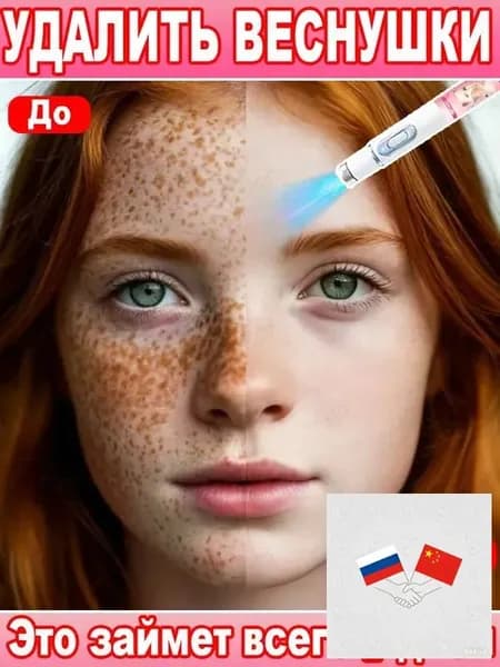 Лазерное удаление веснушек быстро и эффективно удаляет веснушки, пигментные пятна, мелазму и другие виды пигментации; осветляет и выравнивает тон кожи. 1 шт.