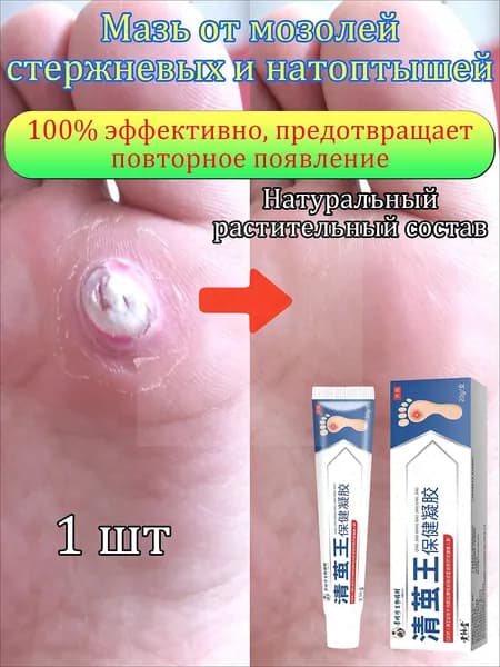 Mазь от мозолей стержневых и натоптышей ,Крем от сухих мозолей, шипицы, бородавок, натоптышей,20 г 1 шт.