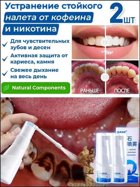 Премиальный спрей от зубного камня, 2 шт.
