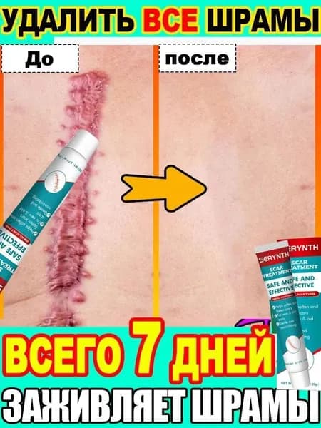 Крем от шрамов и рубцов Осветляет, выравнивает кожу, устраняет следы акне и ожогов 20г