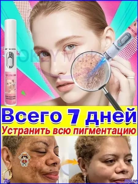 Удаляет пигментные пятна, веснушки, солнечные ожоги, меланодермию, угревую сыпь, морщины.Лазерная указка устраняет пигментацию на лице и теле и отбеливает кожу.1 палочка