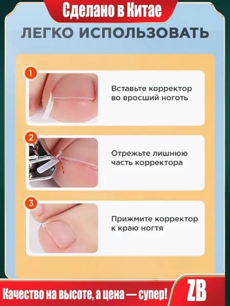 Корректор От Вросших Ногтей На Ногах