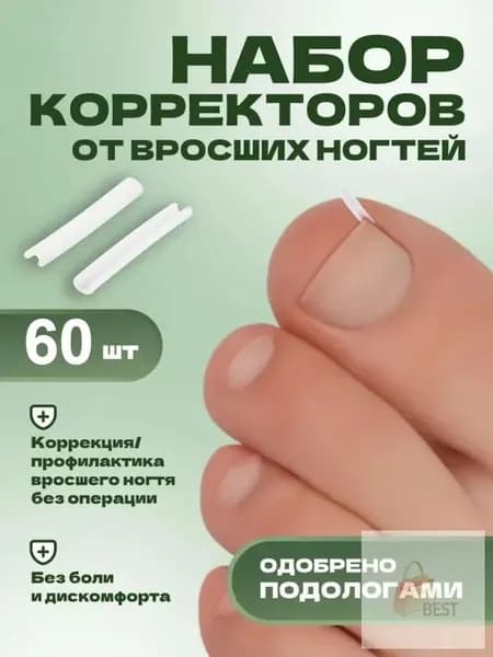 Корректор для вросших ногтей на ногах эффективное решение проблемы