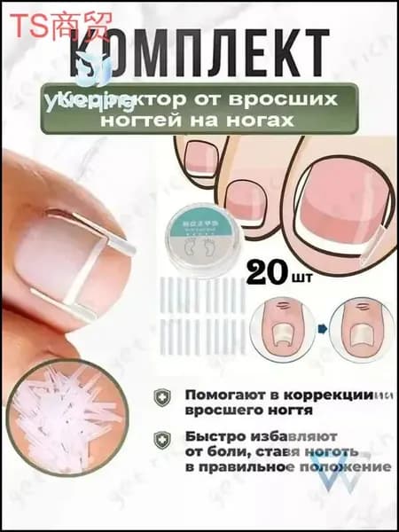 Корректор От Вросших Ногтей На Ногах1