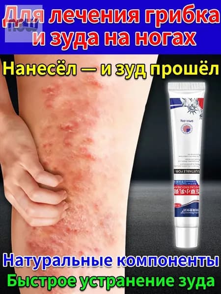 Мазь от крапивницы,Используется для лечения симптомов дерматита,крапивницы,экземы, зуда кожи,китайская чудо