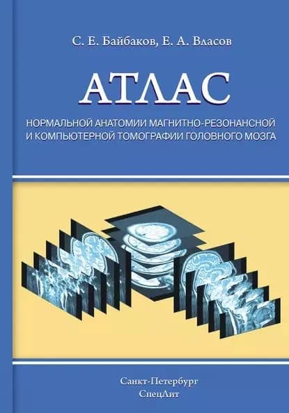 Атлас нормальной анатомии магнитно-резонансной и компьютерной томографии головного мозга | Власов Евгений Александрович, Байбаков Сергей Егорович | Электронная книга