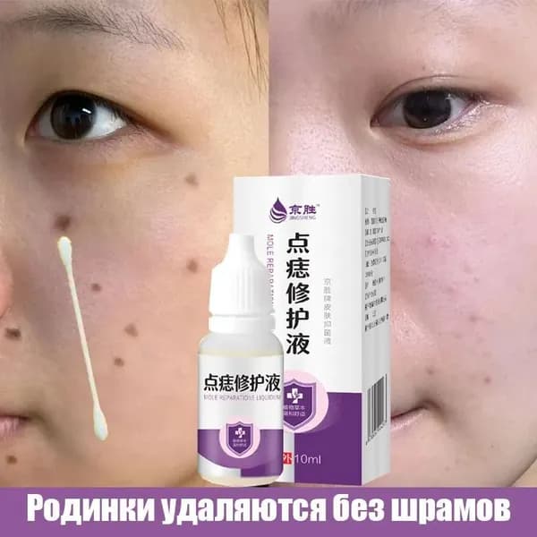 Жидкость, используемая для удаления родинок, пятен, родимых пятен и бородавок, восстанавливает огрубевшую кожу тела, 10 мл