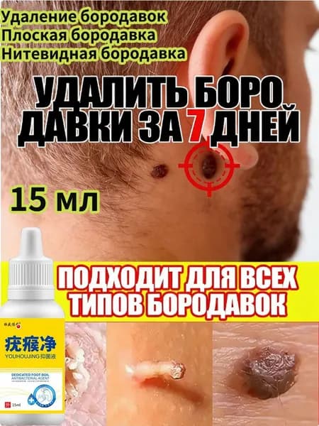 Крем от бородавок. Он используется для удаления бородавок, папиллом и родинок; это безболезненно, не оставляет шрамов, не имеет побочных эффектов и быстро удаляется.15 мл