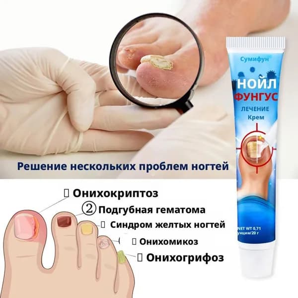 Крем для ухода за ногтями от грибка