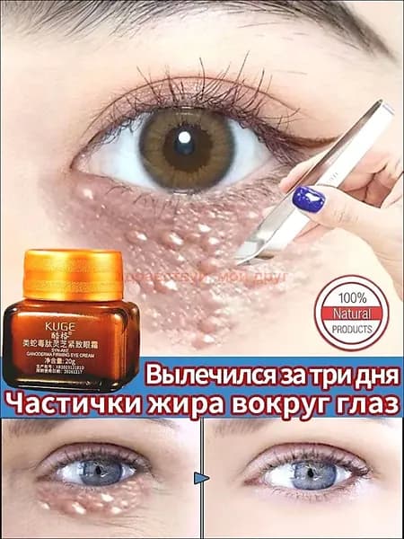 средство от милиумов на лице, Крем для век антивозрастной, для зоны вокруг глаз, ретидерм крем для век антивозрастной, Чистый натуральный, от темных кругов и морщин, отёков вокруг глаз, 20 г