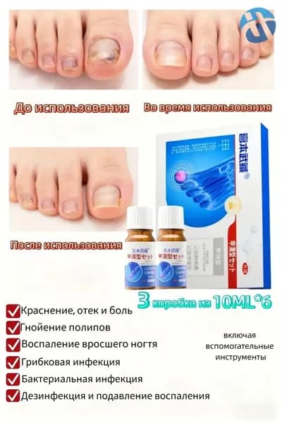 Гиалуроновая сыворотка: восстановление и уход при панариции