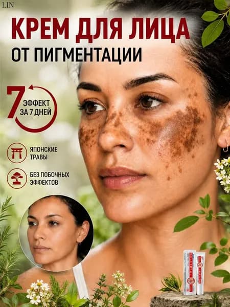 Крем для лица от пигментации ,отбеливающий крем для лица