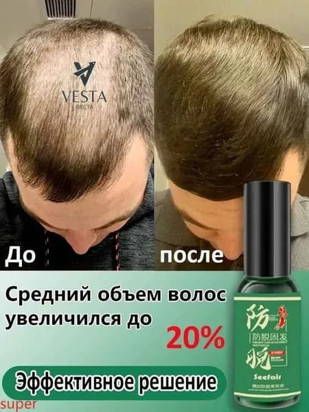 Сыворотка для волос, 30 мл