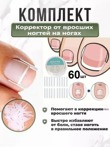 Корректор От Вросших Ногтей На Ногах